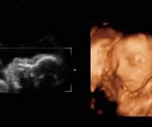 怀孕16周胎儿照片 怀孕后妈妈的肚子变化